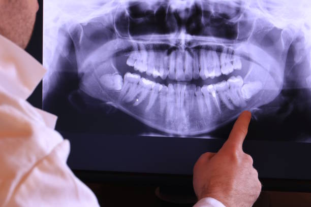 Best Emergency Treatment for Dental Infections or Abscesses in Godfrey, IL